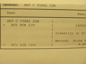 hepatitis c viral load ihelpc